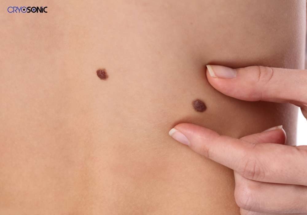 Infection Risk and Poor Aftercare Chesterfield
